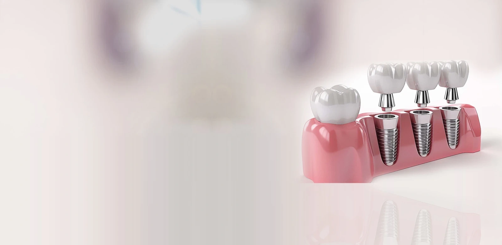 Best dentist in swasthya vihar