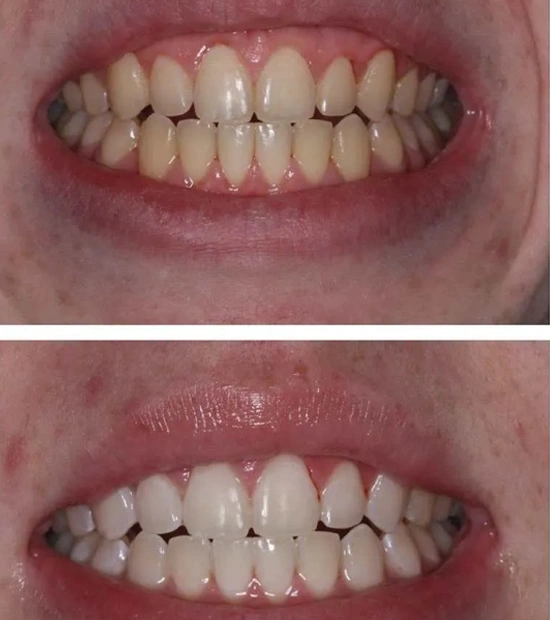 Cosmetic dental clinic in Delhi