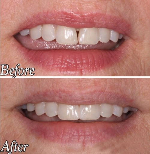 cosmetic dentist east delhi