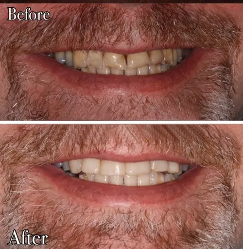 cosmetic dental clinic nirman vihar