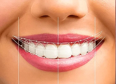 Digital Smile Designing