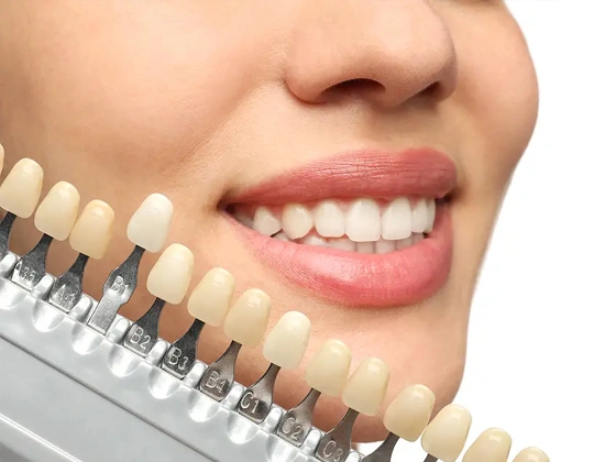 Cosmetic dentistry prices