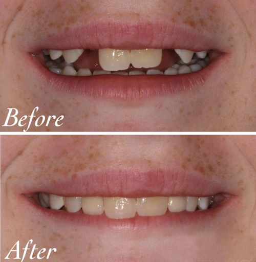  implant dentist nirman vihar