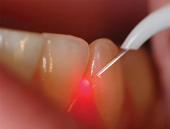 Best Laser Dentists in Nirman Vihar