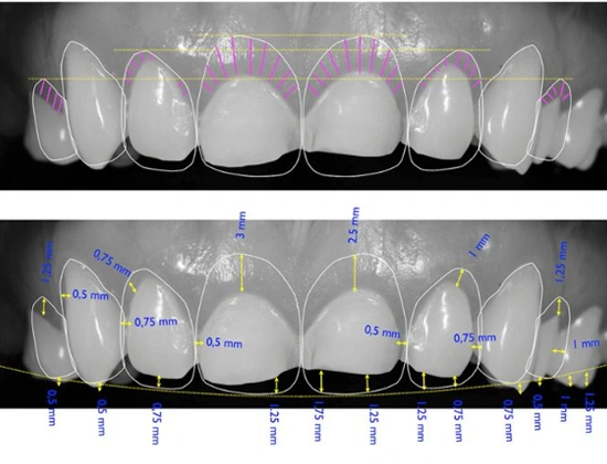 Best cosmetic dentist in East Delhi Delhi